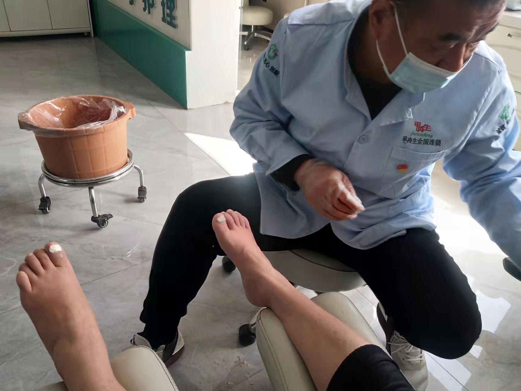 灰指甲是哪些原因造成的？去除用什么方法呢